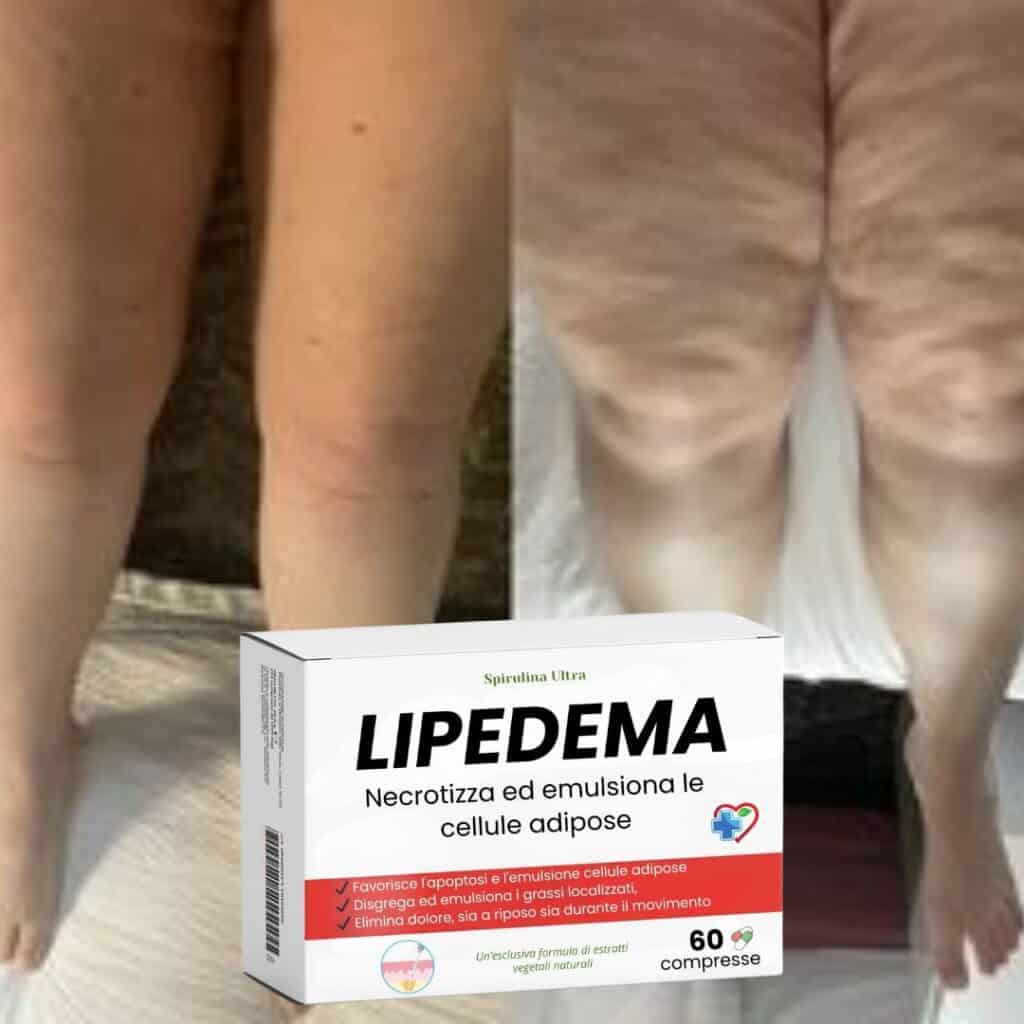 Immagine di gambe affette da lipedema con confezione di compresse herbaliste naturali.