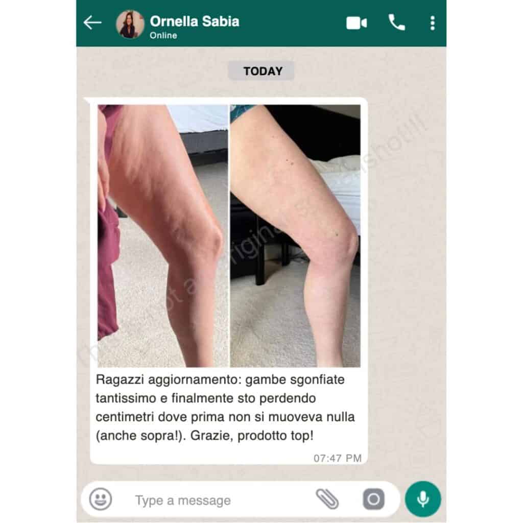 Trasformazione gambe: prima e dopo perdita di peso e tonificazione.
