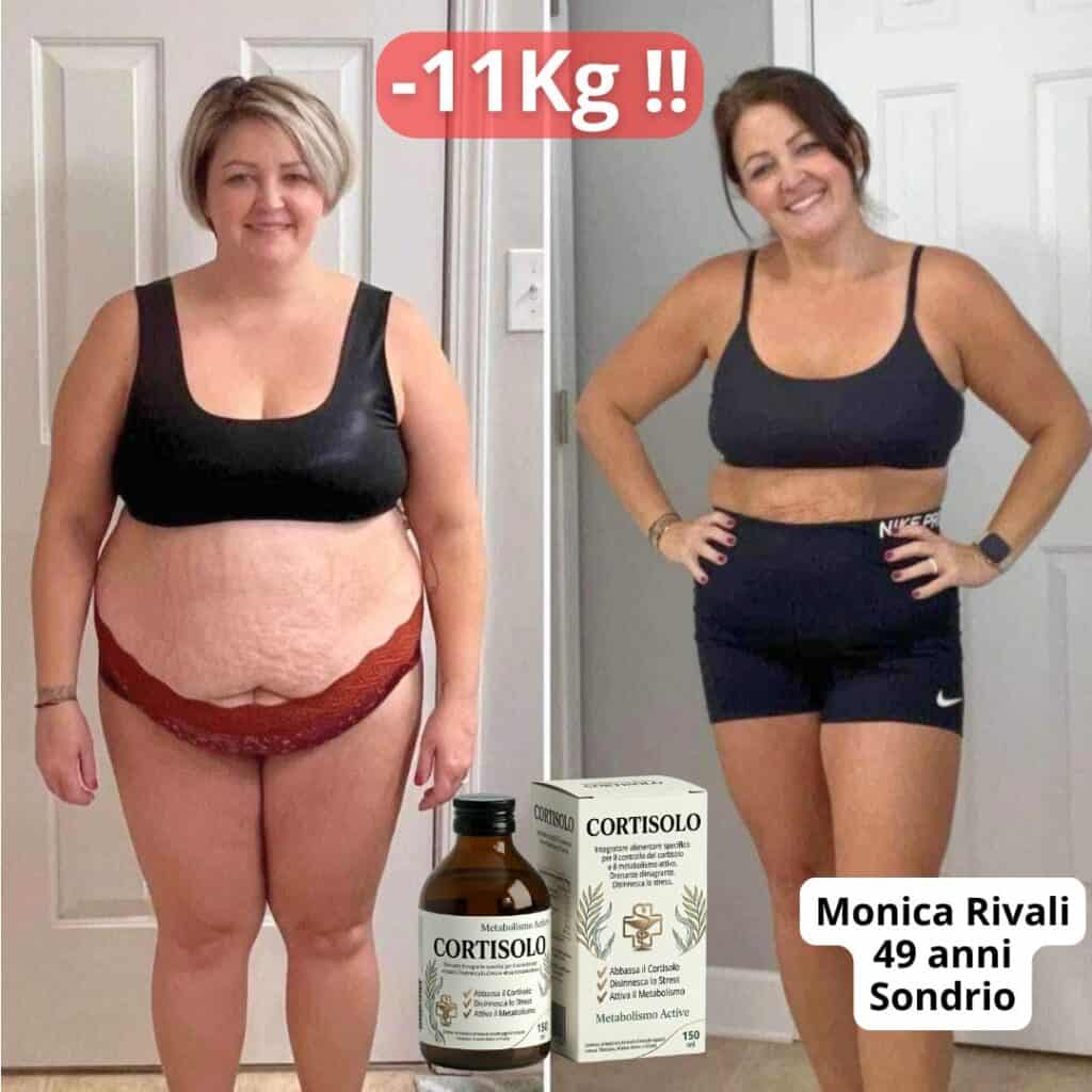 Donna prima e dopo perdita di peso di 11kg con CORTISOL0.