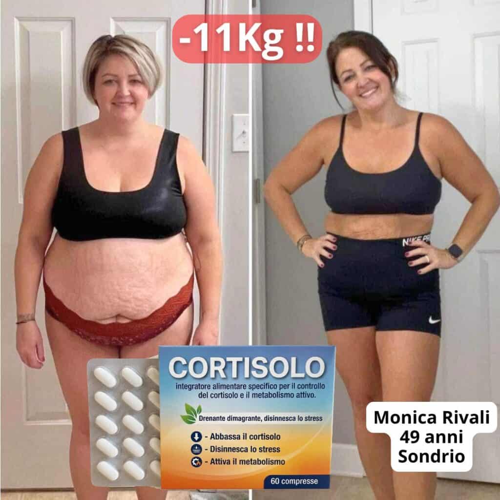 Donna prima e dopo perdita di peso di 11kg con C0RTIS0L0.