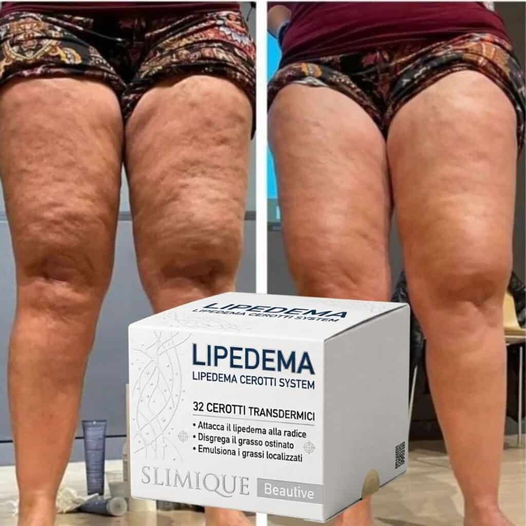 Cerotti LIPEDMA per riduzione cellulite su cosce.
